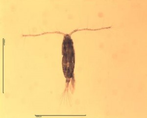 Adult female Acartia clausi with swollen first urosome segment.